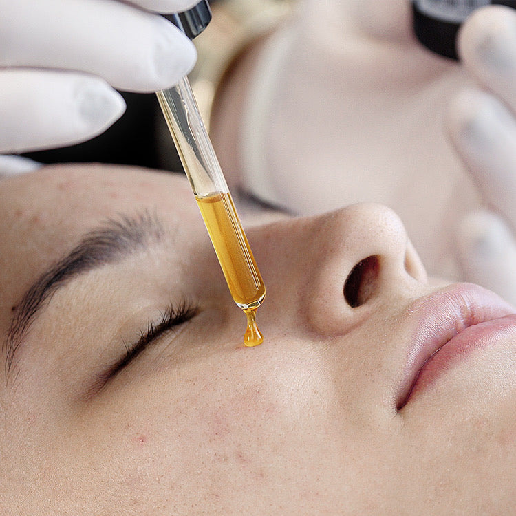 BLACK SECRET PEELING ANTIACNE 30ML